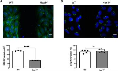 Nox1-based NADPH oxidase regulates the Par protein complex activity to control cell polarization